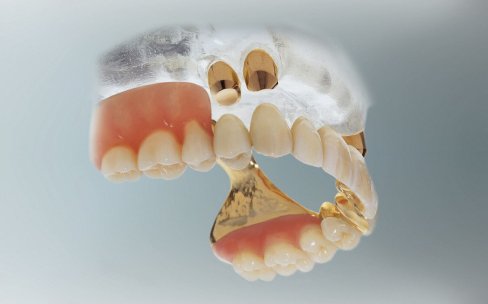 Zahnersatz bild7ze.jpg