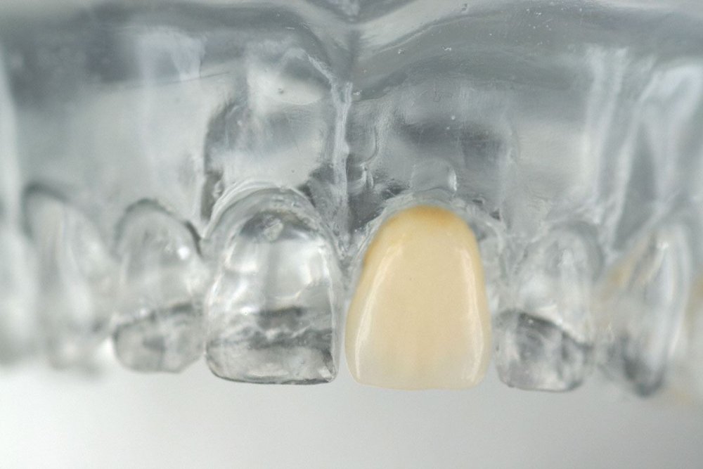 Ästhetik bild15ae.jpg